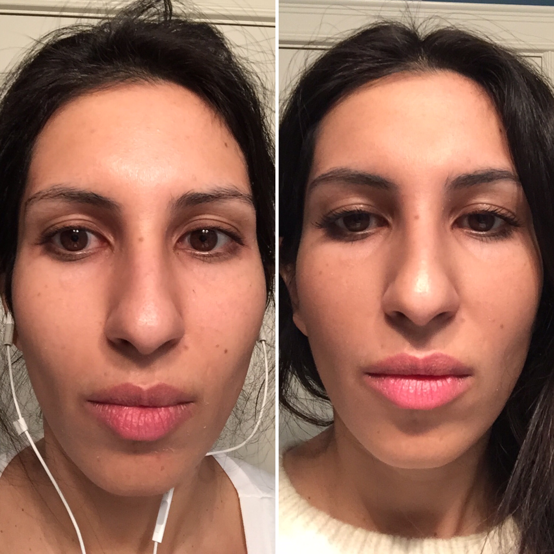 The Year I Said Goodbye to Foundation Thanks to Skinceuticals